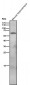 Anti-SPHK1 Monoclonal Antibody